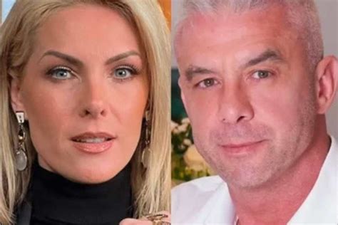 Ex marido de Ana Hickmann posta vídeo sobre como fazer hematomas fake