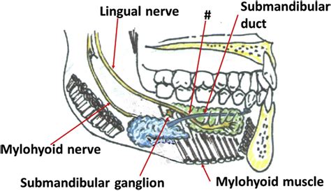 Clinical Anatomy Of The Lingual Nerve A Review Journal Of Oral And