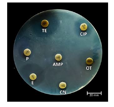 Isolation And Characterization Of The Enterococcus Faecalis Strain