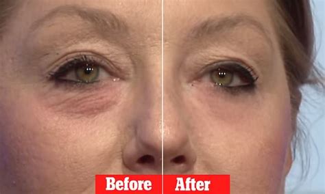 Instantly Ageless Cream Appears To Erase Eye Bags In 45 Seconds Daily