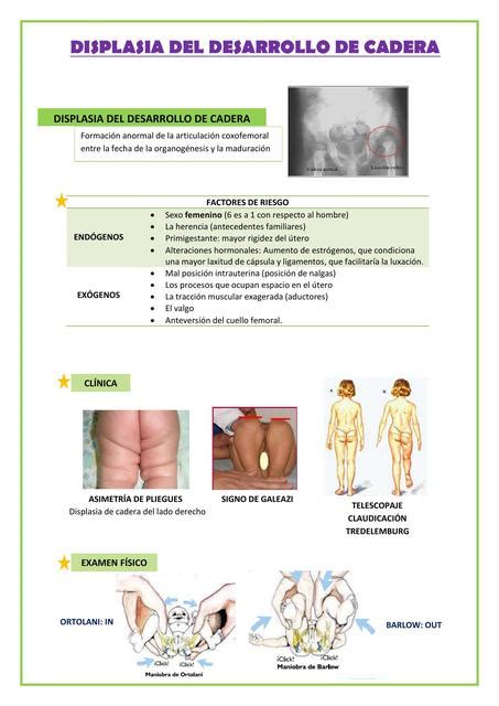 Examen Fisico Displasia De Cadera Online Innoem Eng Psu Ac Th