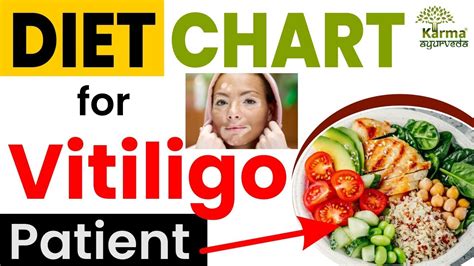 Diet Chart For Vitiligo Patient विटिलिगो पेशेंट का डाइट चार्ट