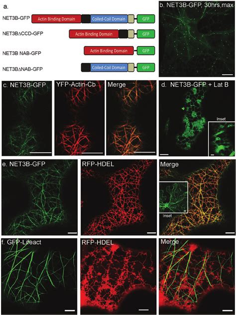 NET3B GFP Co Localizes With Both The Actin Cytoskeleton And The ER In