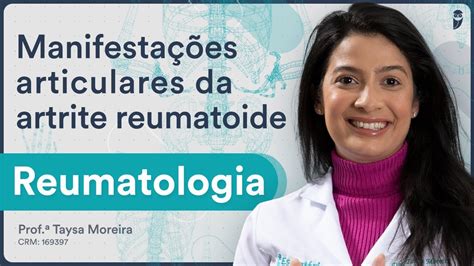 Manifestações articulares da artrite reumatoide Reumatologia para