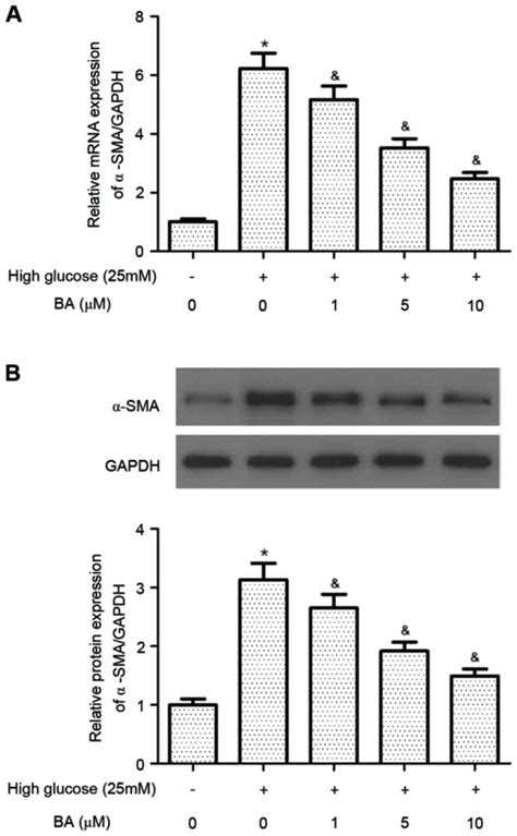 Betulinic Acid Prevents High Glucoseinduced Expression Of