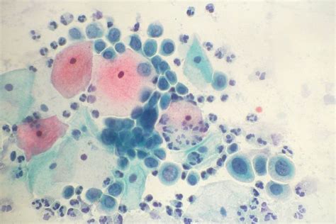 20110826_010 : Tissuepathology.com