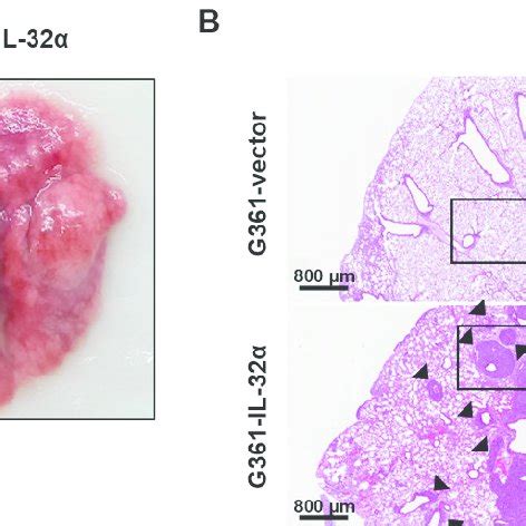 IL 32α expression affects in vivo lung metastasis A The effect of