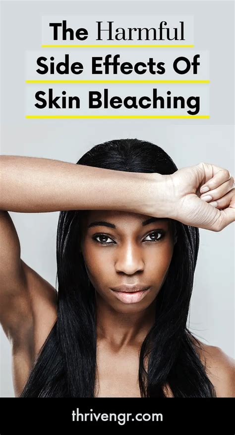 The Harmful Side Effects Of Skin Bleaching | ThriveNaija