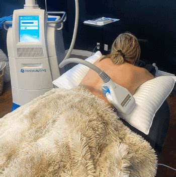 Coolsculpting In Newport Beach Ca Fat Reduction Treatment