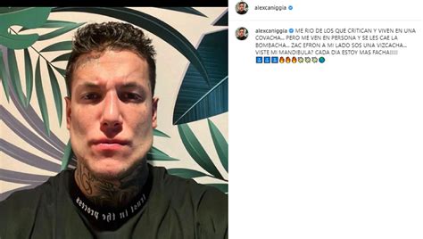 Alex Caniggia Defendió Su Notorio Retoque Estético Con Una Contundente