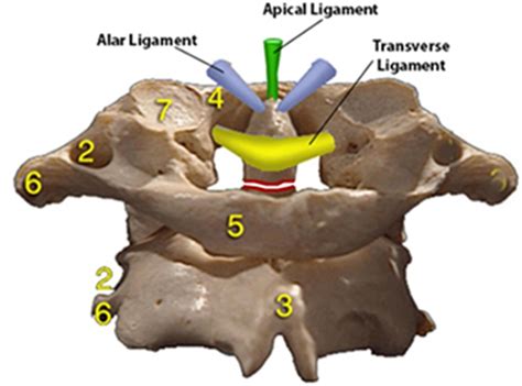 Odontoid Fracture Spine Orthobullets