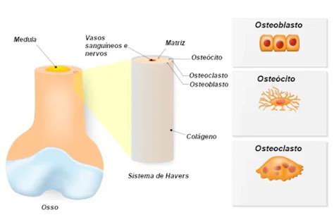 Osteopenia O Que é Causas Sintomas E Tratamentos