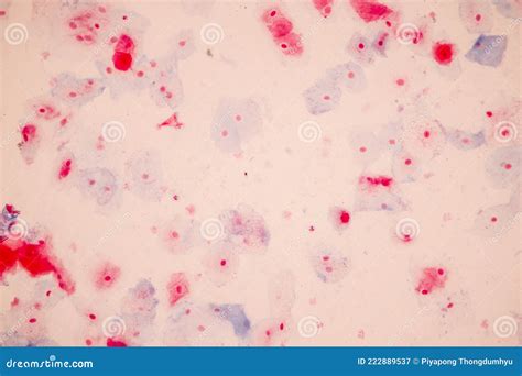 Muestra Histológica Células Epiteliales Escamosas Bajo Microscopio