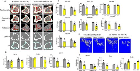 Ovariectomy Induces Bone Loss In Both And Monthold Nox Mice