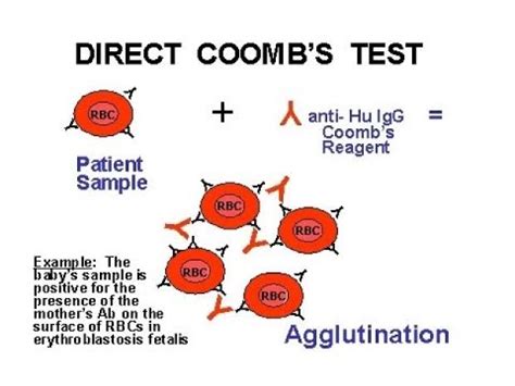 How To Do Direct Coomb S Test YouTube