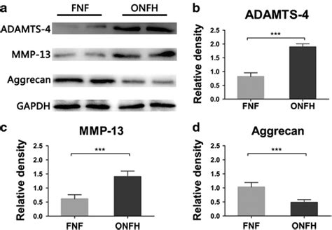 Protein Level Of Adamts And Mmp Is Elevated And Aggrecan Is