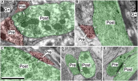 Electron Micrographs Showing Examples Of Gabaergic And Excitatory