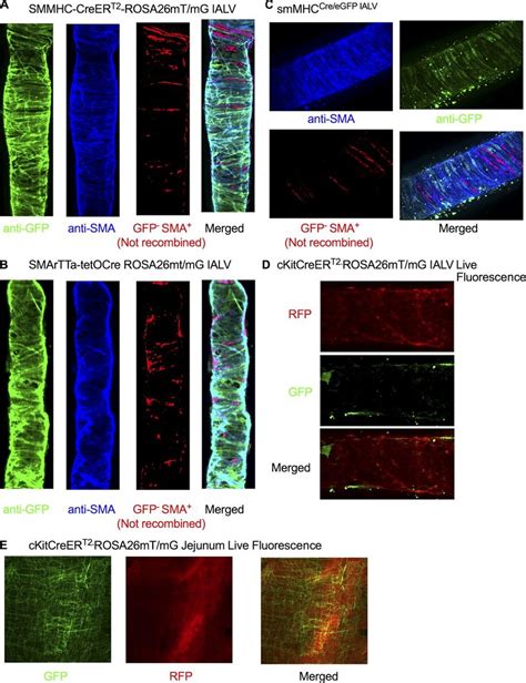 Recombination Efficiency Of Smmhc Creert2 Smartta Tetocre Download Scientific Diagram