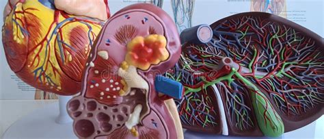 Anatomy Of Heart Human Heart Model And Cardiograph Closeup Stock Image