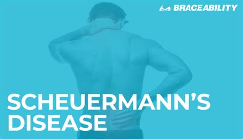 Scheuermann’s Disease: The Truth About Your Child’s Hunched Back