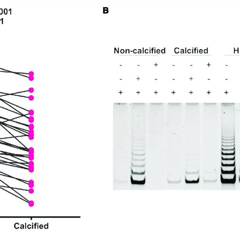 Telomere Length Dynamics In Different Areas Of The As And Sclerotic