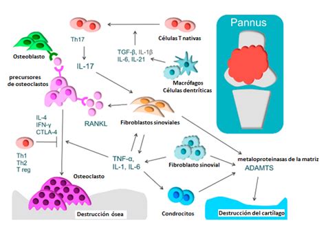 Papel De Las Citoquinas En La Fisiopatolog A De La Artritis Reumatoide