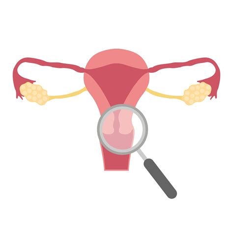 Cervical Ectropion Facts | Clinical Ally