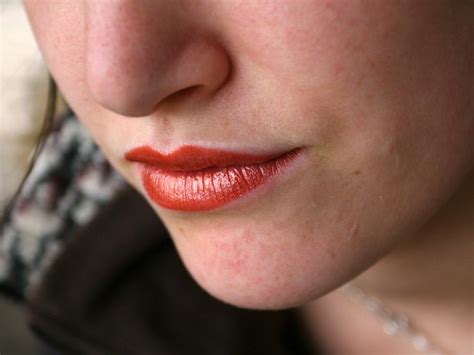 Hiv Mouth Sores What They Look Like And How To Treat Them