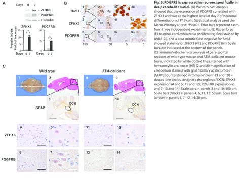 Pdgfrb Is Expressed In Neurons Specifically In Deep Cerebellar Nuclei Download Scientific