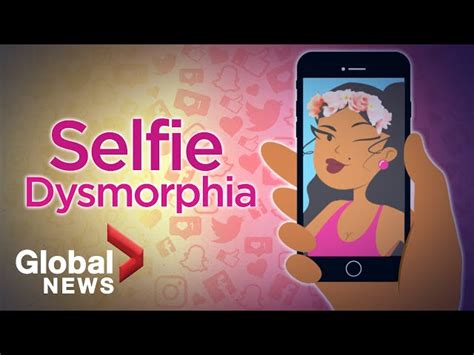 Selfie Dysmorphia How Social Media Filters Are Distorting Beauty 🤳🏽