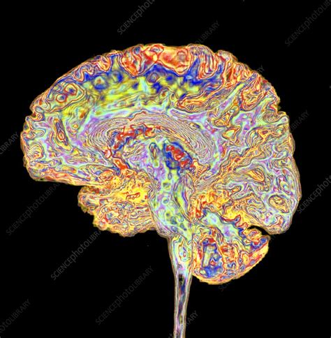 Human Brain 3d Mri Scan Stock Image C0515778 Science Photo Library