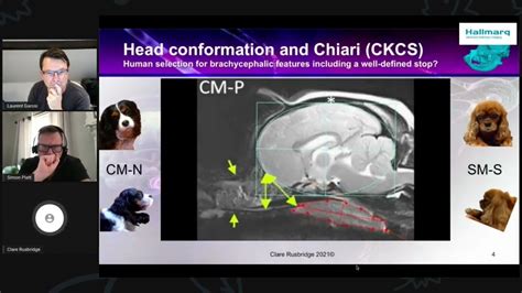 MRI of Syringomyelia