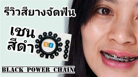 รีวิวสียางจัดฟัน เชนสีดำ Black Power Chain คุยเฟื่องเรื่องจัดฟัน All