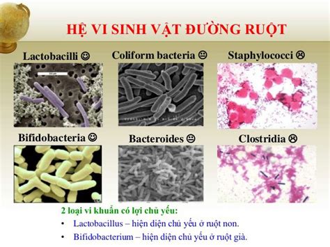 Bệnh viêm ruột và các phổ vi khuẩn đường ruột | Vinmec