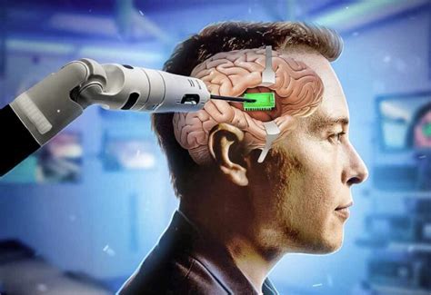 ¡increíble Neuralink La Empresa De Elon Musk Acaba De Realizar El