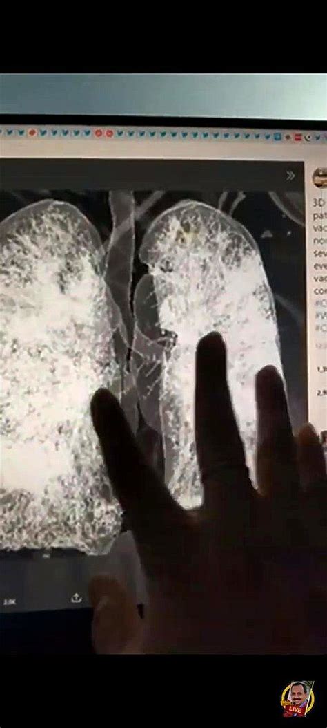 Watch Corona Teenager Hot Teen Threesome Porn SpankBang