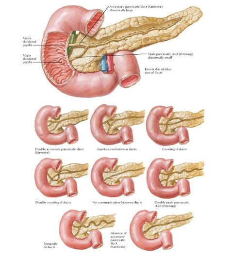 Variations in Pancreatic Duct Anatomy Accessory pancreatic duct ...