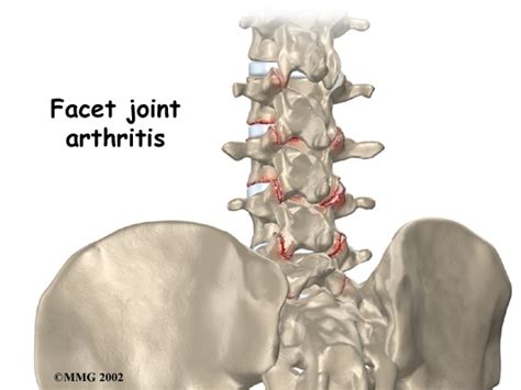 Winchester Chiropractic Center Woburn Ma