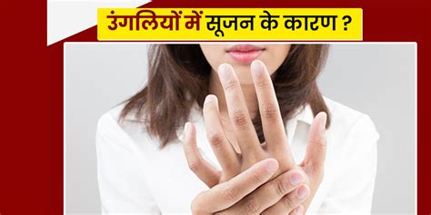 Swollen Fingers Causes In Hindi इन 5 बीमारियों की वजह से हो सकती है आपकी उंगलियों में सूजन