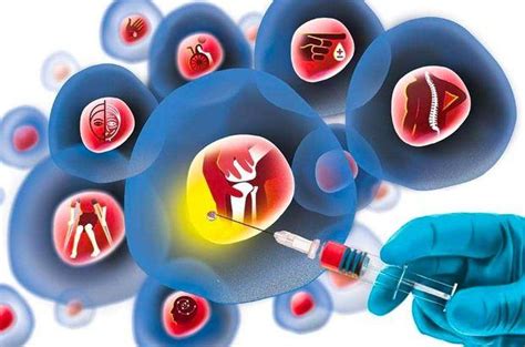 Stem Cell Therapy Market Rapid Growth Research Findings And Key