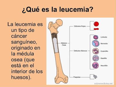 Introducci N A La Leucemia Que Es La Leucemia