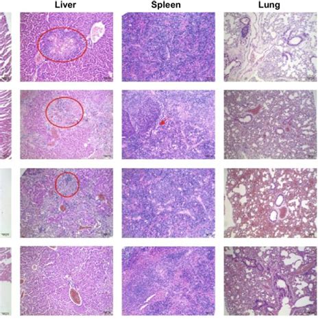 H E Staining Of Major Organs Of Mcf Tumor Bearing Mice After