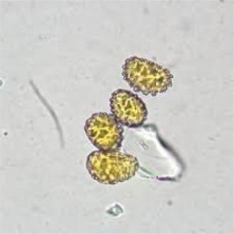 Slide Microscope Fern Sporangia