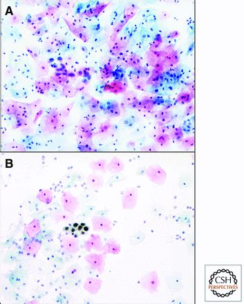 Replication Proteins And Human Disease