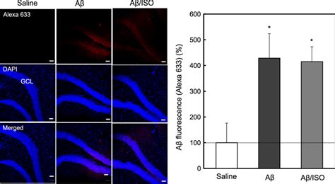 Isoproterenol Does Not Modify Aβ1 42 Uptake After Aβ1 42 Injection Aβ