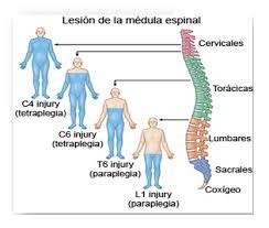 La Transferencia De Nervios En La Lesi N Medular Blog De Fisioterapia