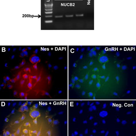 Nucb Mrna Expression A C And Nucb Nesfatin Protein Expression