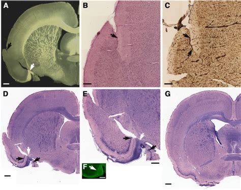 Blast Induced Disruption Of The Piriform Cortex Insular Cortex And Download Scientific