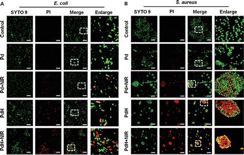 Confocal Images Of A E Coli And B S Aureus With Syto Pi Dual