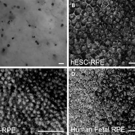 Morphology Of Fetal Rpe Hesc Rpe And Hipsc Rpe A Pigmented Cells